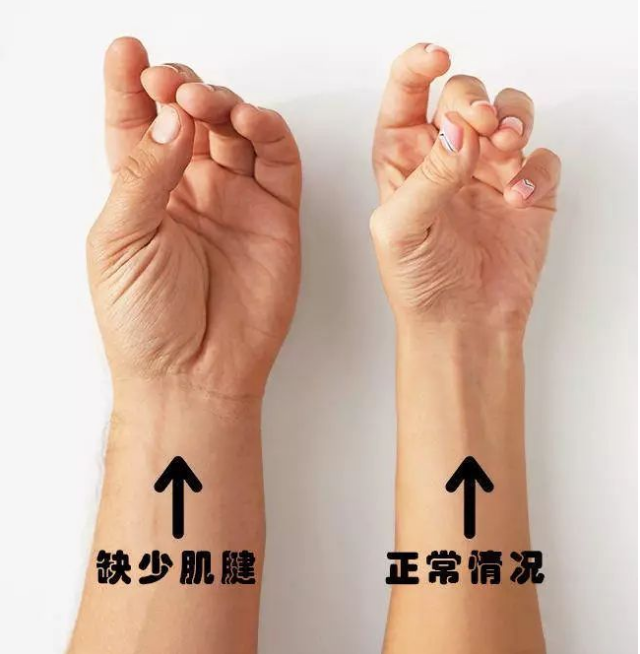 只有少数人才有的“身体罕见特征”，有就证明你天生与众不同！
