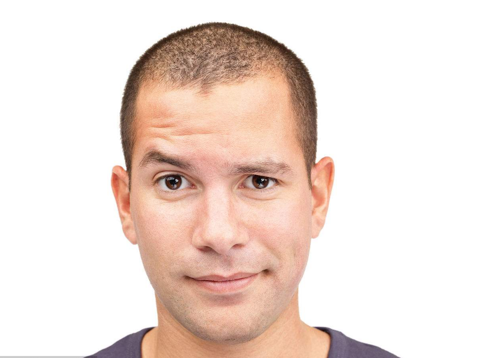 只有少数人才有的“身体罕见特征”，有就证明你天生与众不同！