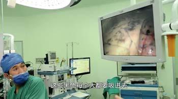 柴静《穹顶之下》关于雾霾的22个敏感点