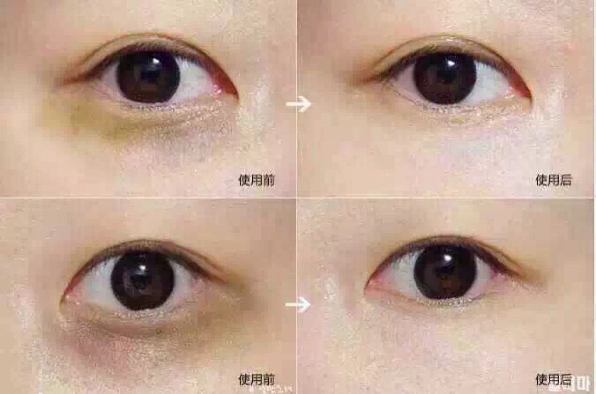 2eda0003818ea48562c3?from=pc