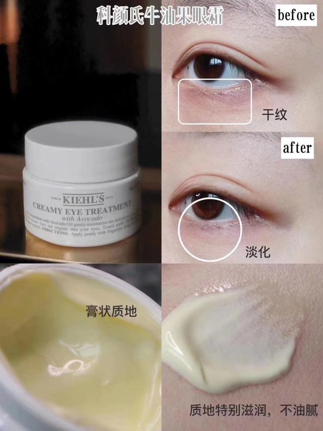 KIEHL'S科颜氏牛油果眼霜真的好用吗——还你一双明眸