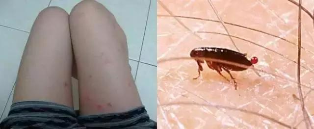 如果发现家中有跳蚤，只需这样做，跳蚤就通通不见了！