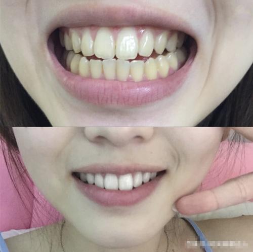 李佳琦力荐的“牙膏”火了，效果贼好，网友：牙膏中的香奈儿