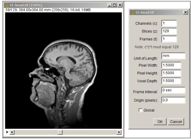 老司机带你解锁ImageJ三维图片分析技巧