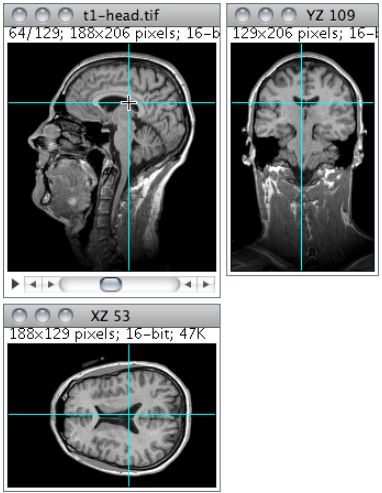 老司机带你解锁ImageJ三维图片分析技巧